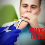 Saiba rudo sobre Remoção do Dente do Siso