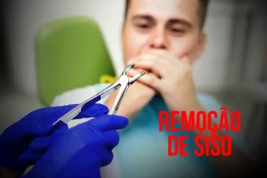 Saiba rudo sobre Remoção do Dente do Siso