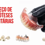 Preços de Prótese Dentárias