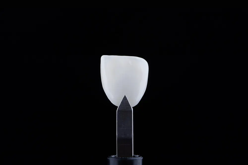 Dicas e duvidas sobre lente de contato dental