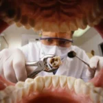 Extração de Dente: quando fazer e quanto custa