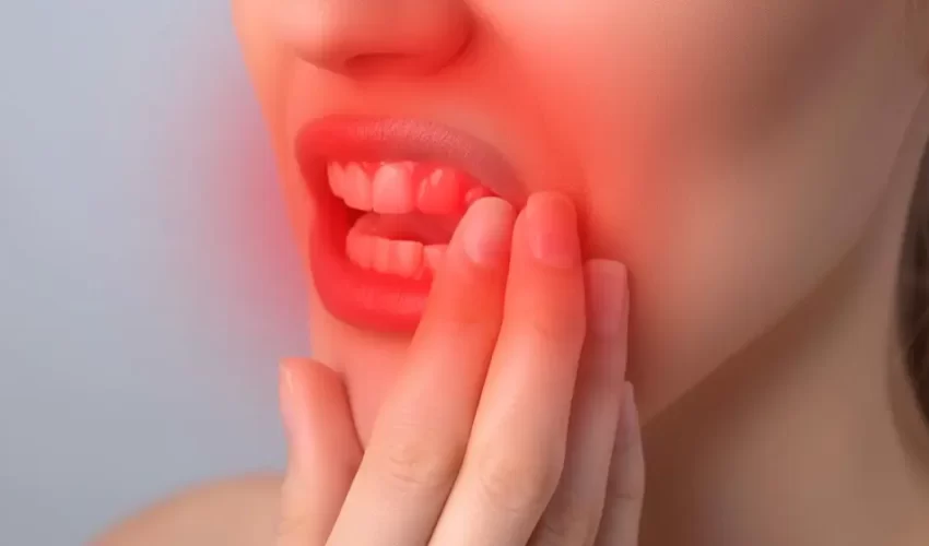 Gengivoestomatite Herpética