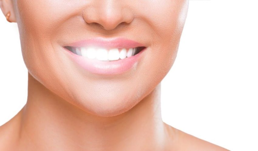 img-clareamento-dental-no-consultorio