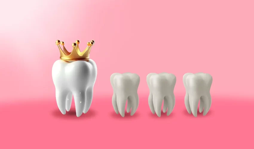 img coroas dentárias tipos casos e precos