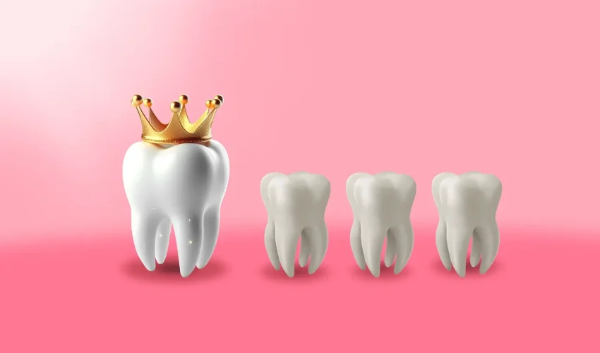 img coroas dentárias tipos casos e precos