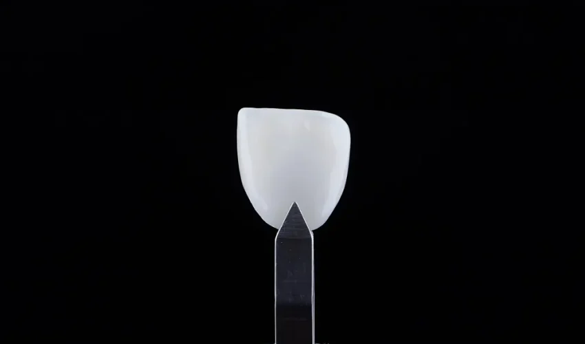 Dicas e duvidas sobre lente de contato dental