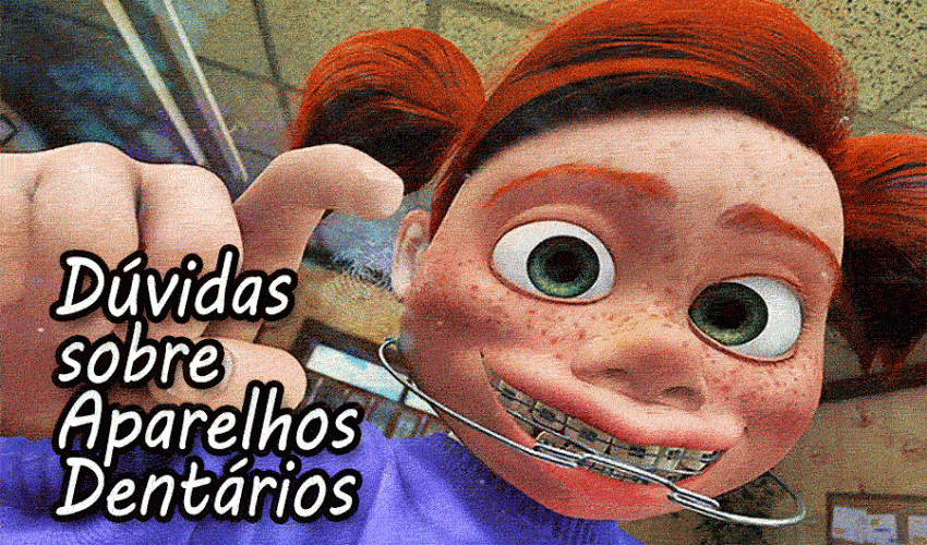 Perguntas frequentes sobre aparelhos dentários e alinhadores invisíveis