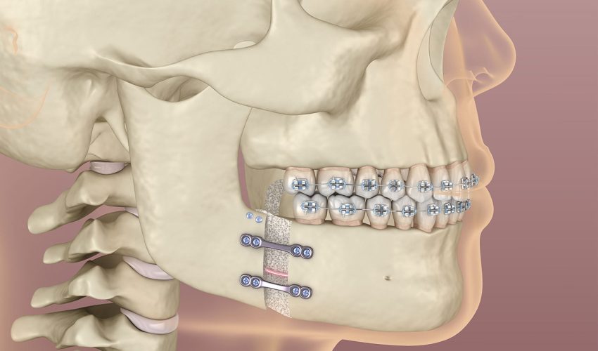 Como séculos de endogamia levaram à distinta 'mandíbula de