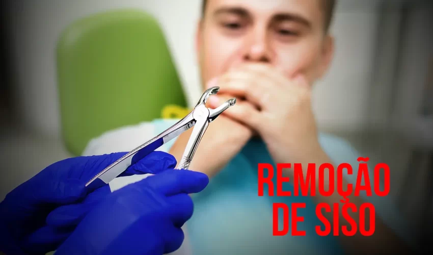 Saiba rudo sobre Remoção do Dente do Siso