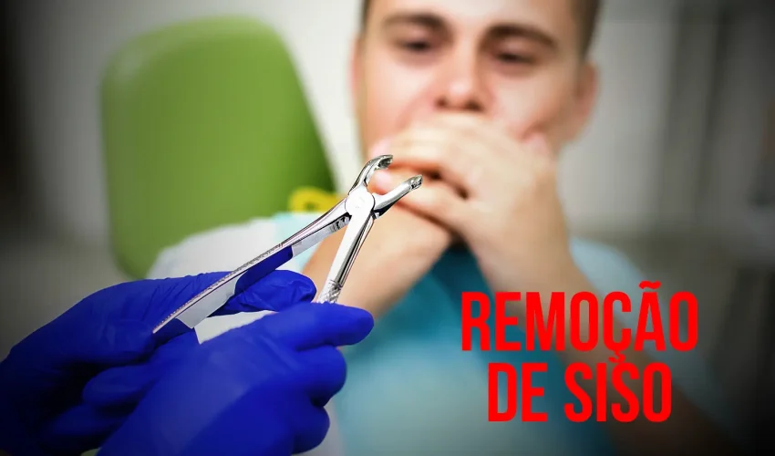 Saiba rudo sobre Remoção do Dente do Siso