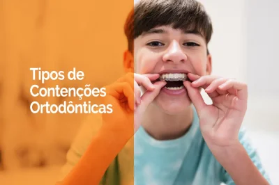 tipos de aparelhos de contenção