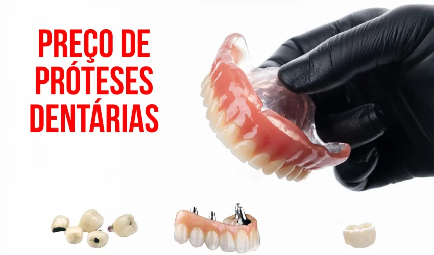 Preços de Prótese Dentárias
