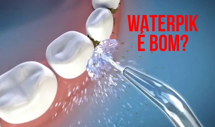 Waterpik é bom?