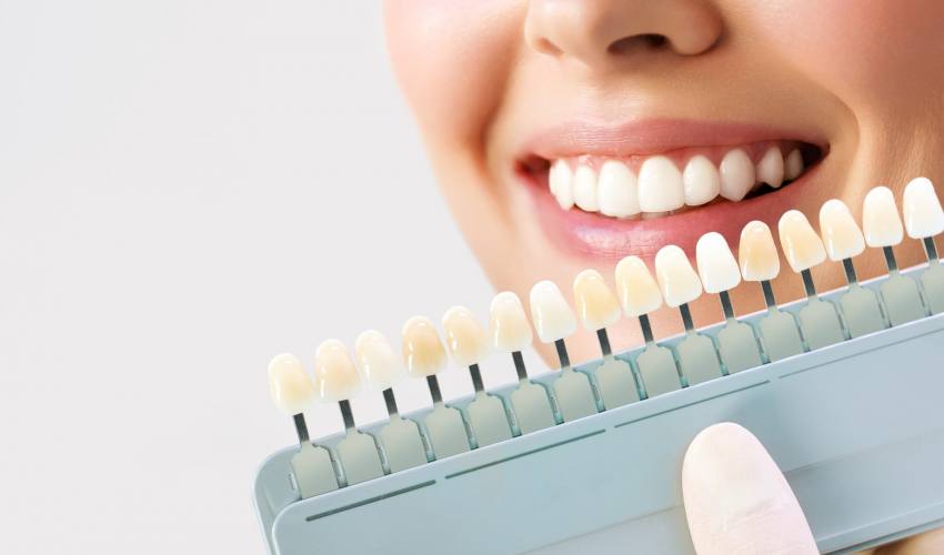 smiling-young-woman-cosmetological-teeth-whitening-in-a-dental-clinic-selection-of-the-tone-of-the